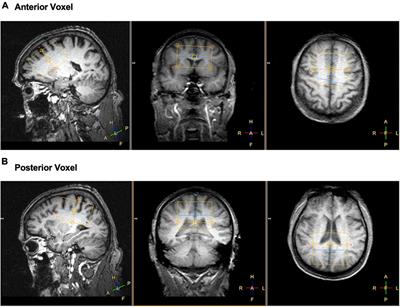 Frontal adenosine triphosphate markers from 31P MRS are associated with cognitive performance in healthy older adults: preliminary findings